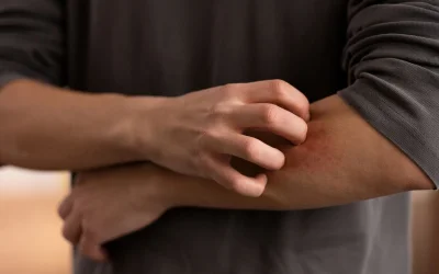 Το υλικό της κουζίνας που θα κρατήσει τα κουνούπια μακριά
