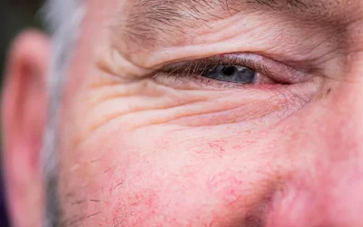 Η νόσος Αλτσχάιμερ και η επίδρασή της στην όραση