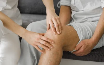 Κιρσοί στα πόδια: Αίτια, συμπτώματα και τρόποι μείωσης του κινδύνου