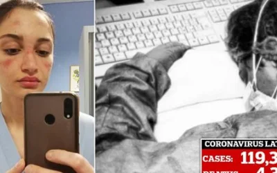 Ιταλία: Νοσοκόμες με μώλωπες στο πρόσωπο μετά από πολύωρες βάρδιες