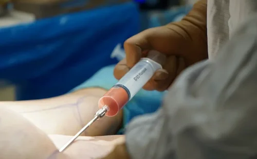 Επεμβάσεις ομορφιάς χωρίς γιατρούς: Θάνατοι και σοκαριστικές αποκαλύψεις για τα παράνομα fillers