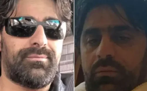Με σοβαρή εγκεφαλική βλάβη στη ΜΕΘ του ΚΑΤ 53χρονος ομογενής μετά από εμφύτευση δοντιών στην Τουρκία
