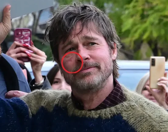 Μπραντ Πιτ: Η αναστάτωση στο κέντρο της Αθήνας και το «μυστηριώδες» σημάδι για χάρη του «The Riders»