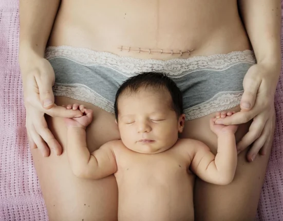 Το συγκλονιστικό σχεδιάγραμμα πουαποδεικνύει γιατί η καισαρική δεν είναι ο «Εύκολος Δρόμος»