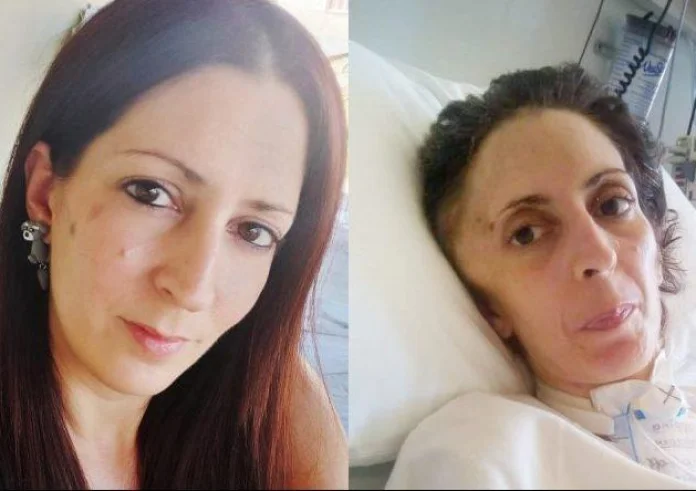 Κατέληξε η 41χρονη Όλγα που ξυλοκοπήθηκε βάναυσα από τον σύντροφό της - Θα υπάρξει αλλαγή στην ποινή του;