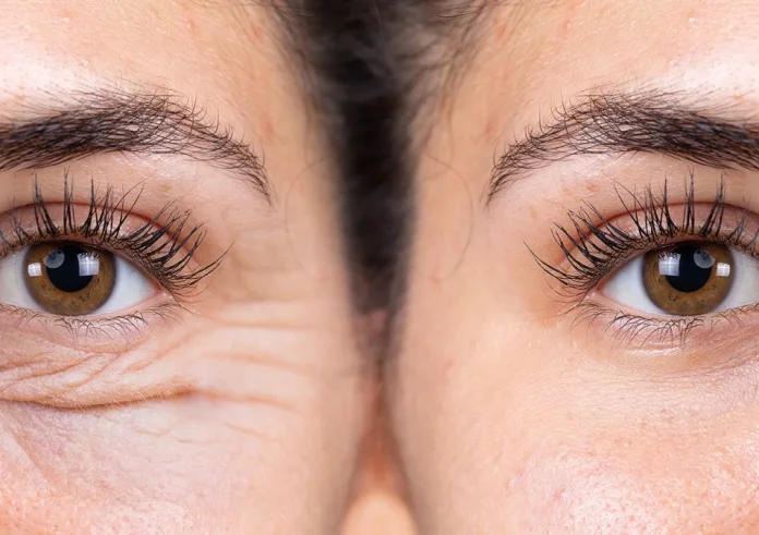 Το concealer που πρέπει να επιλέξετε μετά τα 50 για να μειώσετε τις ρυτίδες