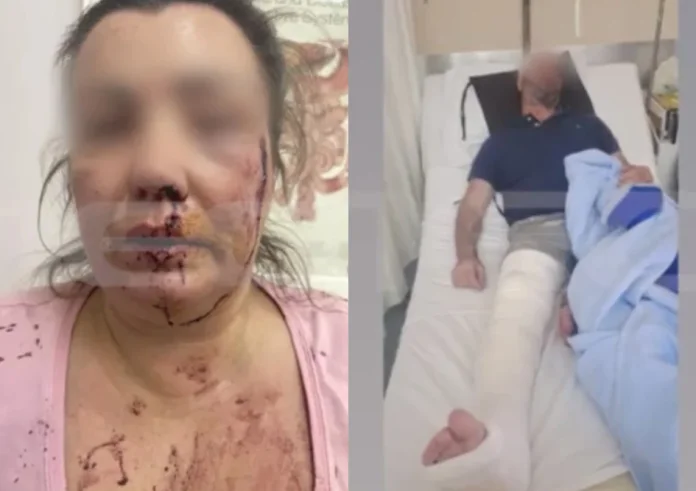 Αιγάλεω: Ζευγάρι έπεσε θύμα άγριου ξυλοδαρμού μέρα μεσημέρι στην Πέτρου Ράλλη – «Ήθελαν να μας σκοτώσουν»