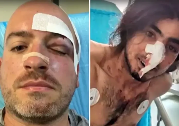 Σοκάρει η άγρια επίθεση που δέχτηκαν εθελοντές στην Πάρνηθα από ομάδα επτά ατόμων
