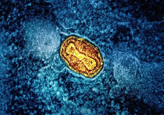 Συναγερμός για την εξάπλωση του ιού Mpox στην Ευρώπη – Πώς μεταδίδεται και ποιοι κινδυνεύουν
