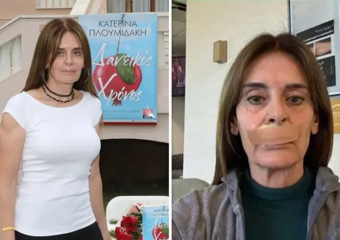 Κατερίνα Πλουμιδάκη: Έχω κάνει 21 χειρουργεία. Μάχη αποκατάστασης μετά από ιατρικό λάθος