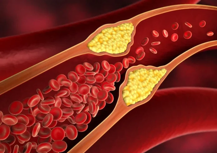 Χυμός «μαγικό ελιξίριο»: Ποιος χυμός βοηθά στη μείωση της χοληστερίνης