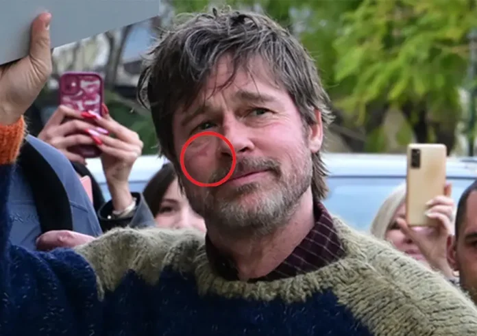 Μπραντ Πιτ: Η αναστάτωση στο κέντρο της Αθήνας και το «μυστηριώδες» σημάδι για χάρη του «The Riders»