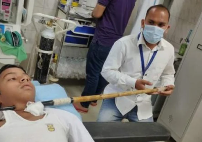 Ακόντιο καρφώθηκε στο λαιμό 14χρονου στην Ινδία και δεν έχασε καν τις αισθήσεις του
