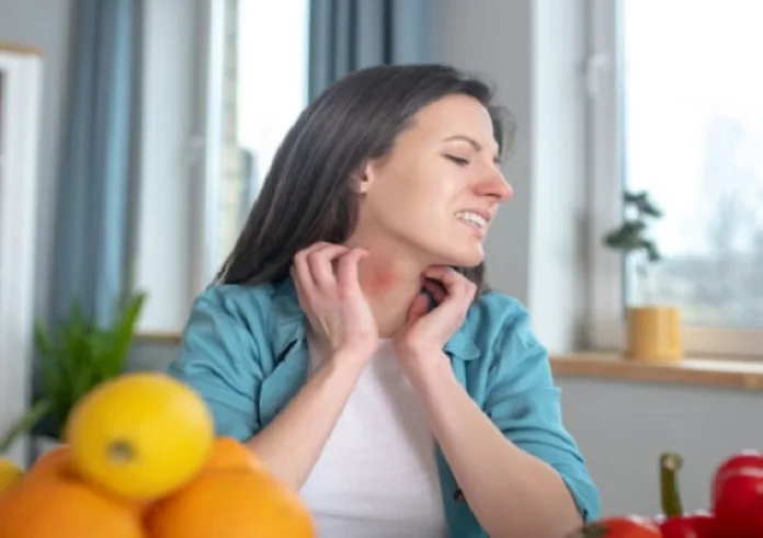Tips για πρόληψη από τροφικές αλλεργίες