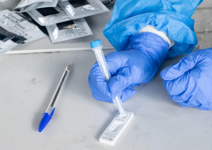 Rapid test: Πού γίνονται δωρεάν την Πέμπτη 24/11