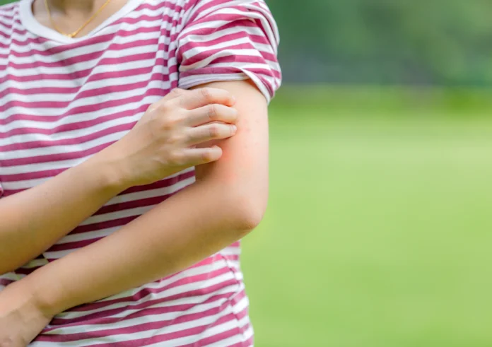 Συναγερμός για τη νόσο Lyme - Πάνω από το 14% του παγκόσμιου πληθυσμού είναι φορέας