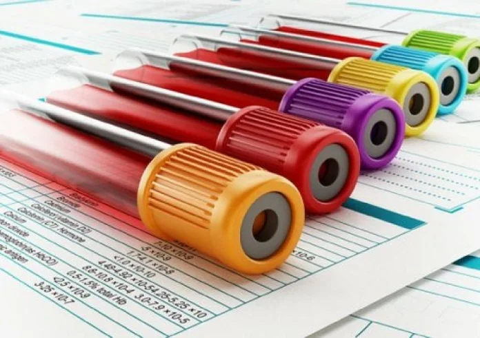 Κορονοϊός: Πάνω από 4.700 rapid test σε 36 περιοχές – Τα αποτελέσματα